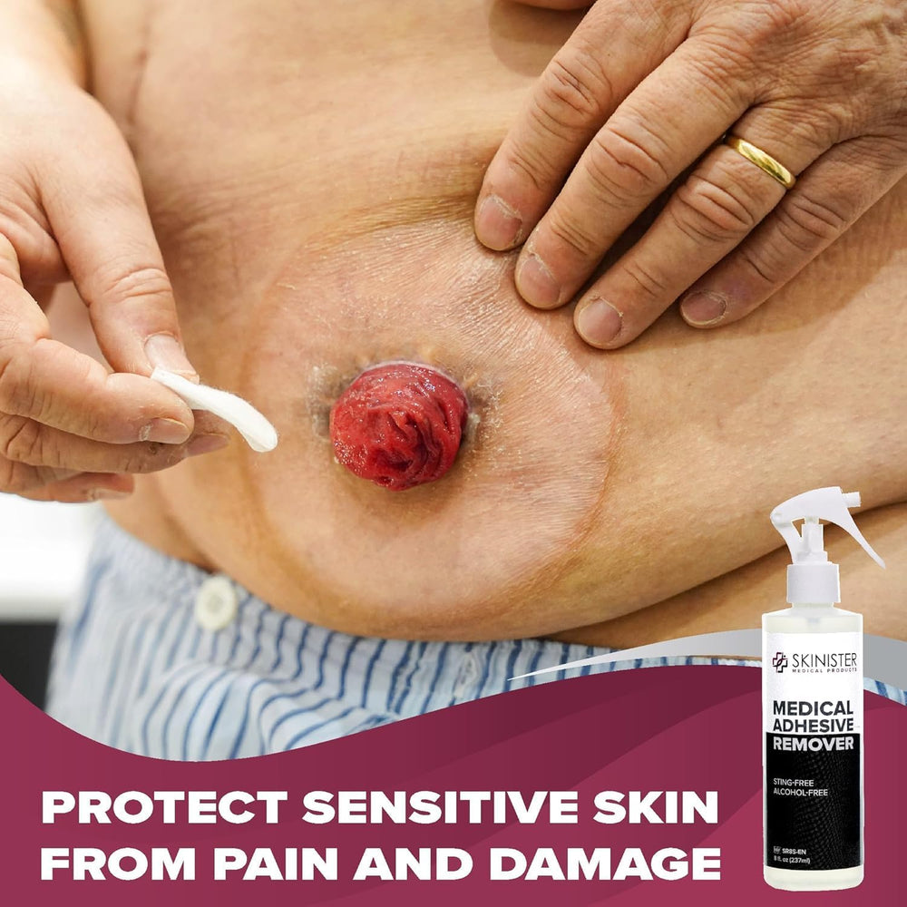 Medical Adhesive Remover for Skin