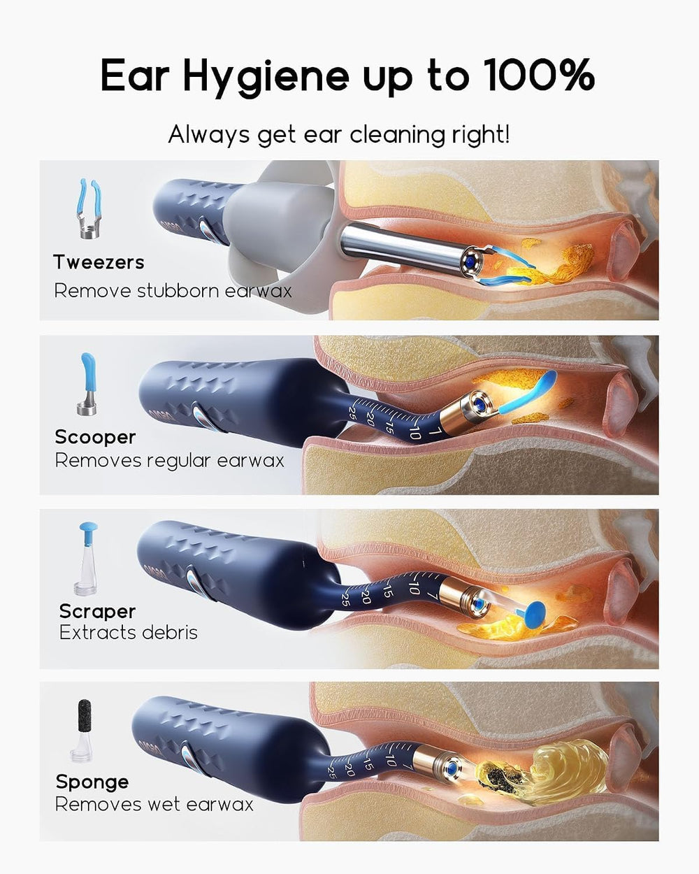 Bebird D39R Ear Wax Removal: Ear Camera with Storage Case&Painless Tweezers